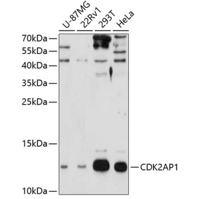 CDK2AP1 Rabbit Polyclonal Antibody