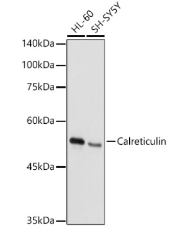 Calreticulin Rabbit Polyclonal Antibody