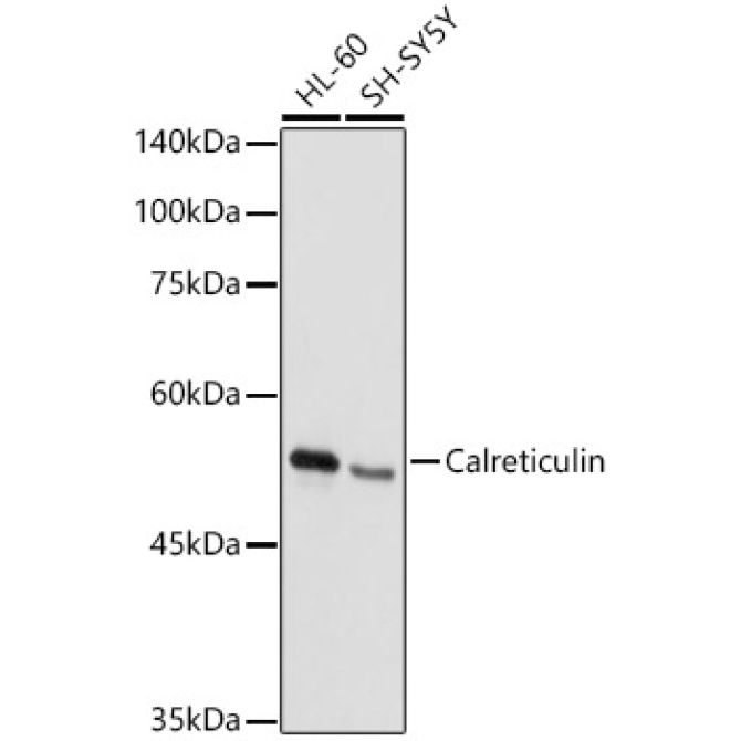 Calreticulin Rabbit Polyclonal Antibody