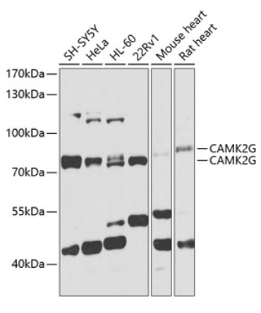 CAMK2G Rabbit Polyclonal Antibody