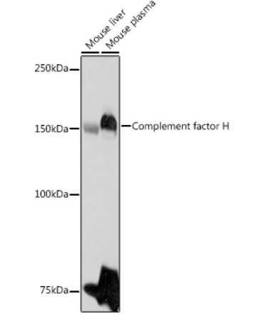 Complement factor H Rabbit Polyclonal Antibody
