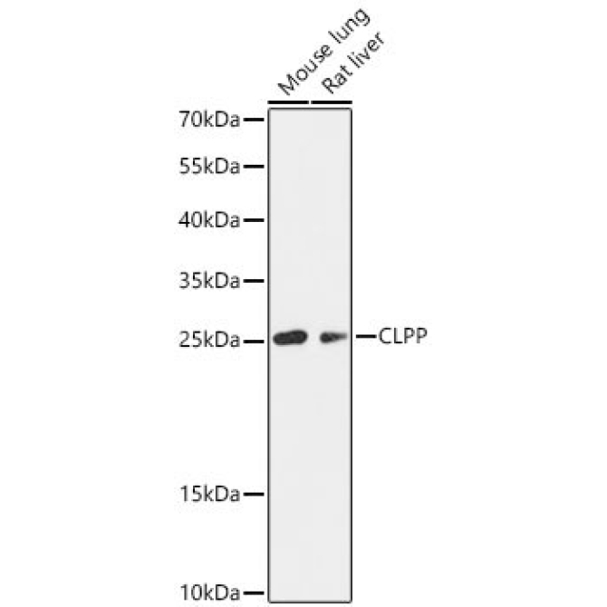 CLPP Rabbit Polyclonal Antibody