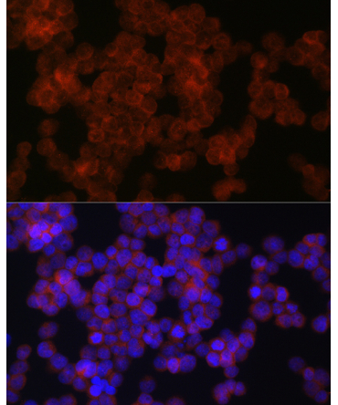 AXIN2 Rabbit Polyclonal Antibody
