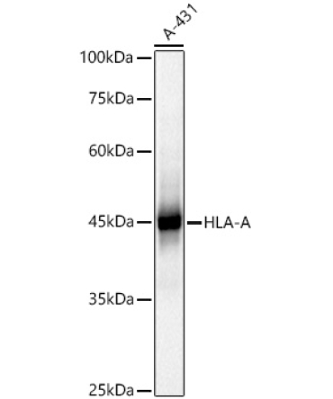 HLA-A+HLA-B+HLA-C Rabbit Polyclonal Antibody