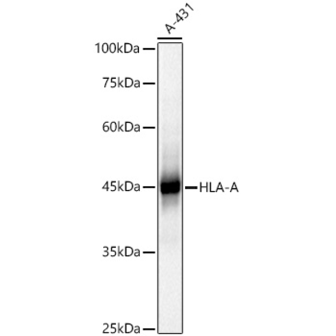 HLA-A+HLA-B+HLA-C Rabbit Polyclonal Antibody