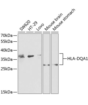 HLA-DQA1 Rabbit Polyclonal Antibody