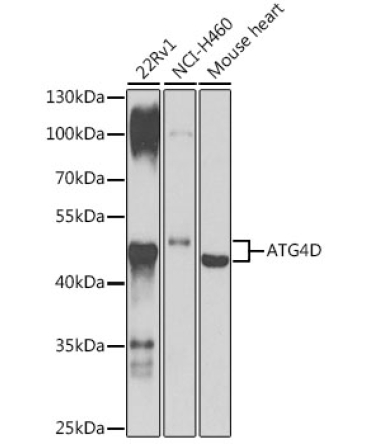 ATG4D Rabbit Polyclonal Antibody