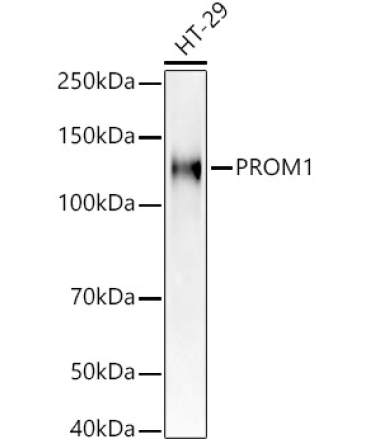 PROM1 Rabbit Polyclonal Antibody [KD Validated]