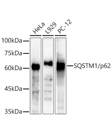 SQSTM1/p62 Rabbit Polyclonal Antibody [KO Validated]