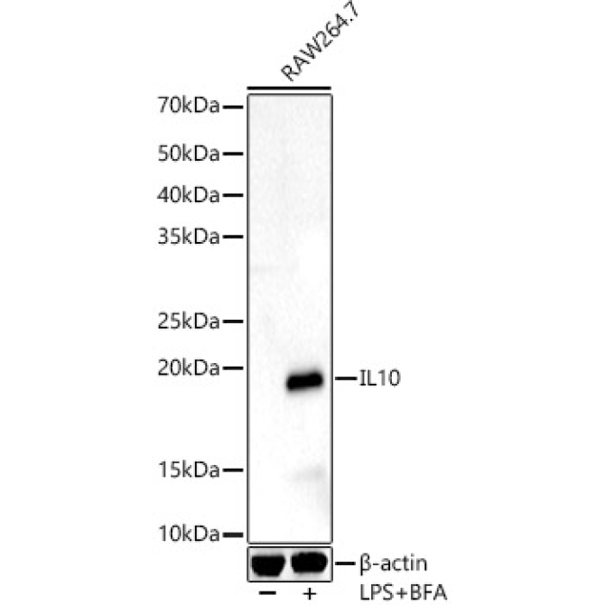 IL10 Rabbit Polyclonal Antibody