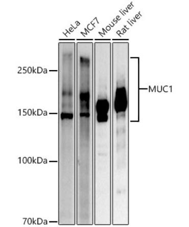 MUC1 Rabbit Polyclonal Antibody