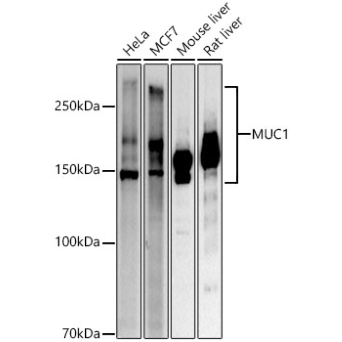 MUC1 Rabbit Polyclonal Antibody