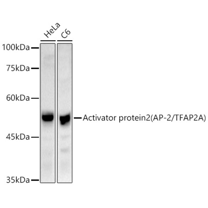 Activator protein 2 (AP-2/TFAP2A) Rabbit Polyclonal Antibody