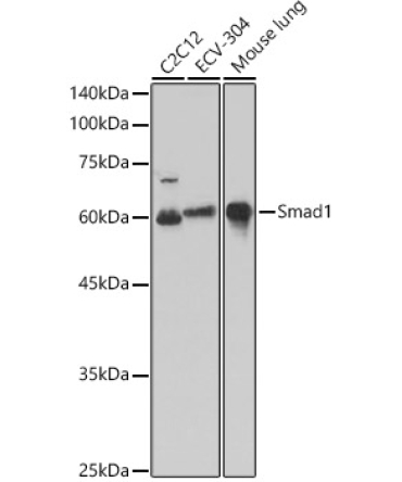 Smad1 Rabbit Polyclonal Antibody [KO Validated]