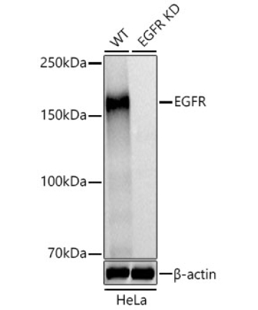 EGFR Rabbit Polyclonal Antibody [KD Validated]