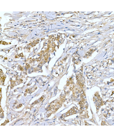 LDHA Rabbit Polyclonal Antibody