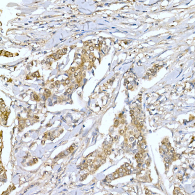LDHA Rabbit Polyclonal Antibody