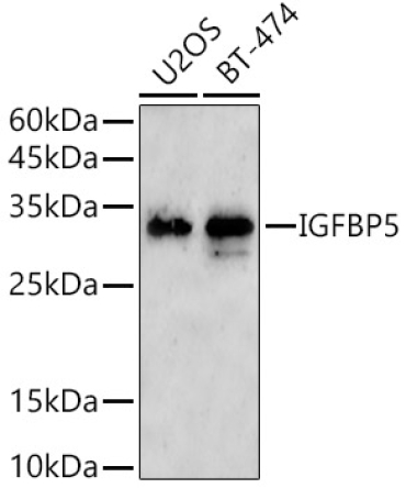 IGFBP5 Rabbit Polyclonal Antibody [KO Validated]