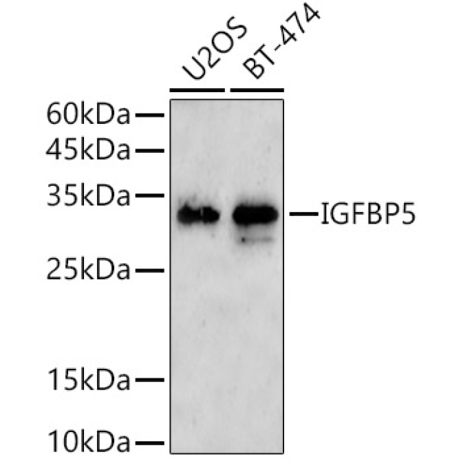 IGFBP5 Rabbit Polyclonal Antibody [KO Validated]