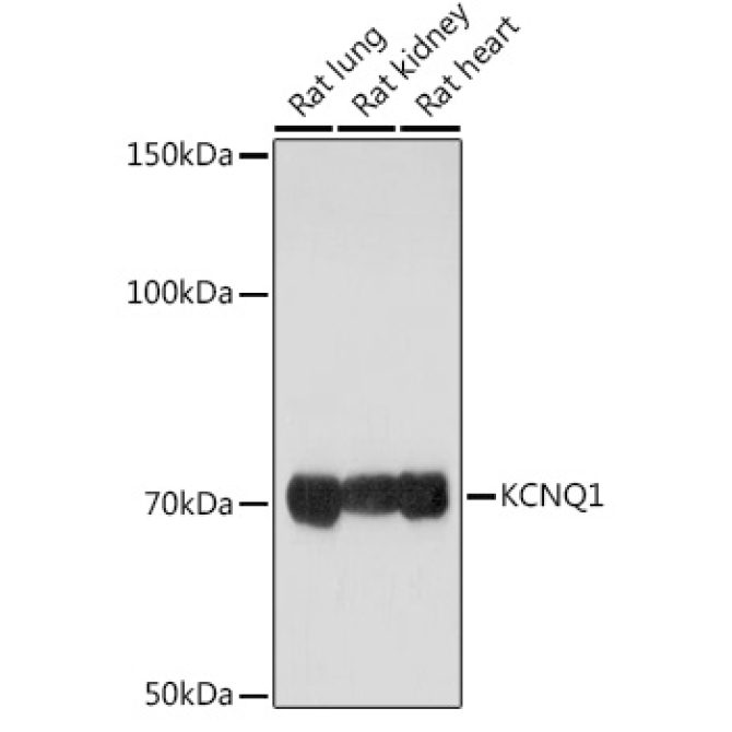 KCNQ1 Rabbit Polyclonal Antibody