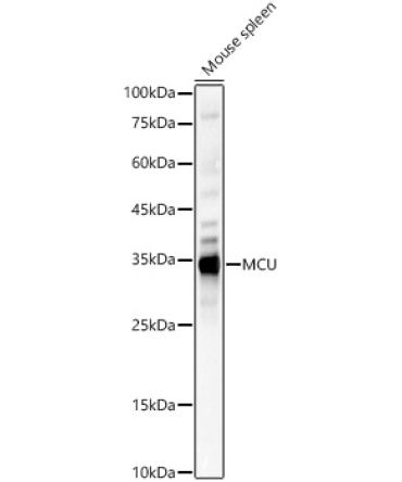 MCU Rabbit Polyclonal Antibody