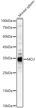 MCU Rabbit Polyclonal Antibody