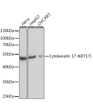 Cytokeratin 17 (KRT17) Rabbit Polyclonal Antibody