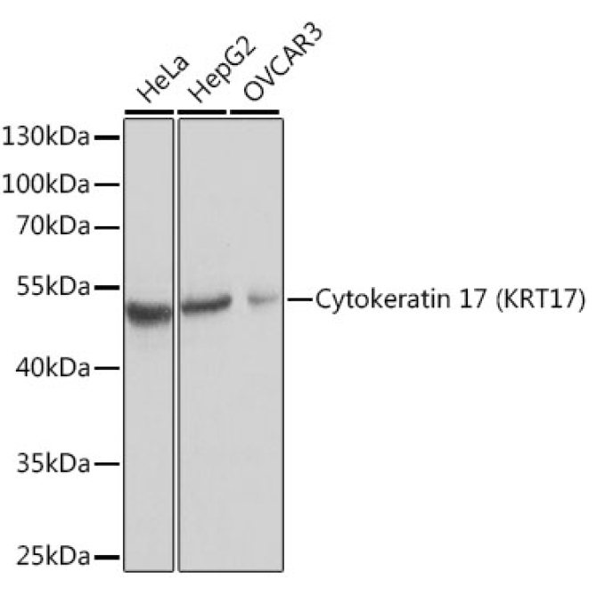 Cytokeratin 17 (KRT17) Rabbit Polyclonal Antibody