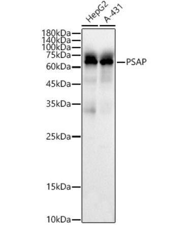 PSAP Rabbit Polyclonal Antibody [KO Validated]