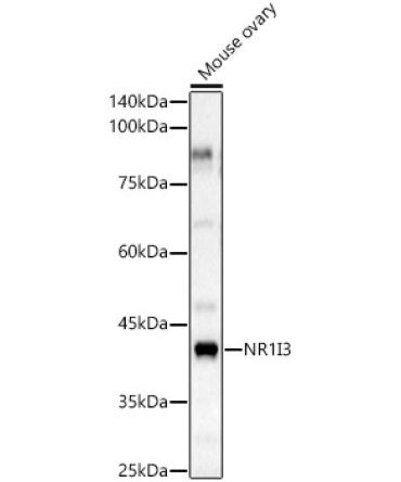 NR1I3 Rabbit Polyclonal Antibody