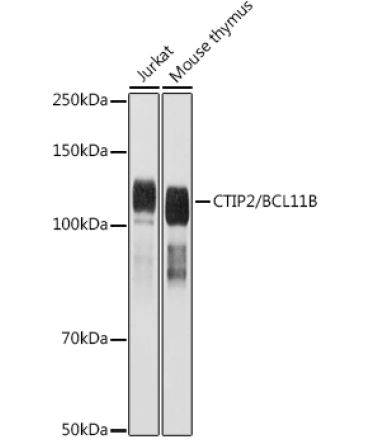 CTIP2/BCL11B Rabbit Polyclonal Antibody