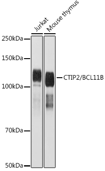 CTIP2/BCL11B Rabbit Polyclonal Antibody