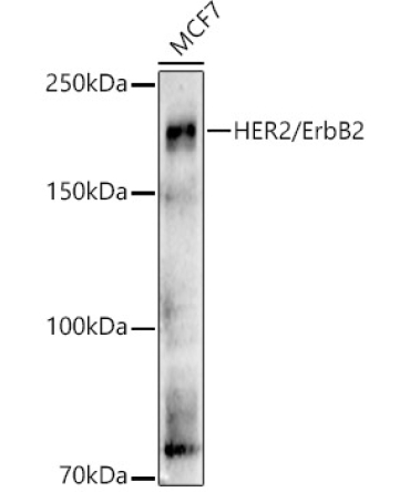 HER2/ErbB2 Rabbit Polyclonal Antibody [KO Validated]
