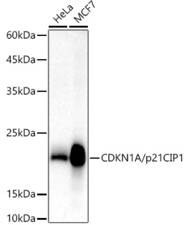 CDKN1A/p21CIP1 Rabbit Polyclonal Antibody
