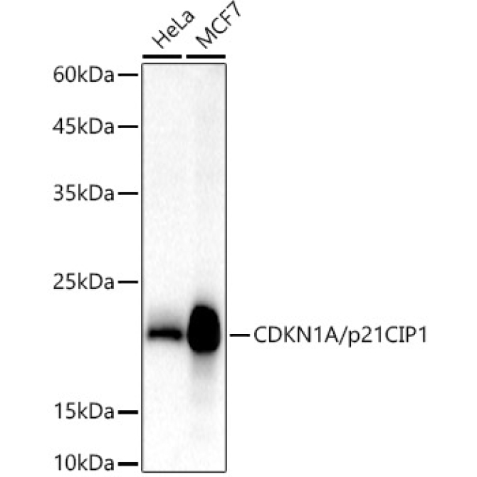 CDKN1A/p21CIP1 Rabbit Polyclonal Antibody