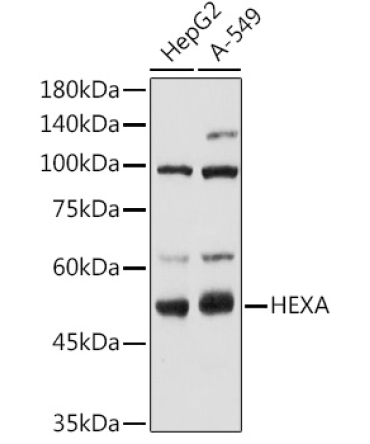 HEXA Rabbit Polyclonal Antibody