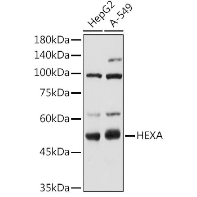 HEXA Rabbit Polyclonal Antibody