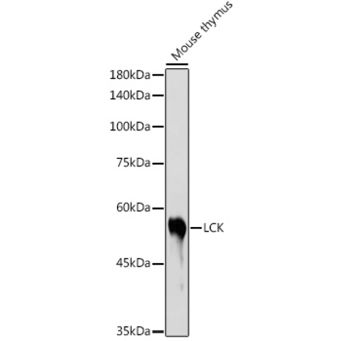 LCK Rabbit Polyclonal Antibody