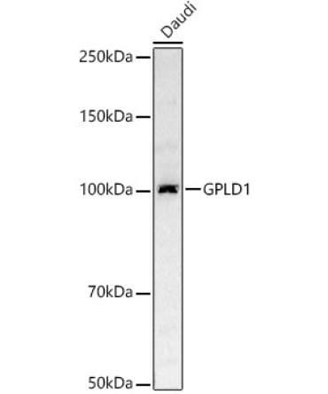 GPLD1 Rabbit Polyclonal Antibody [KD Validated]