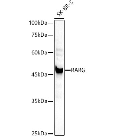 RARG Rabbit Polyclonal Antibody [KD Validated]