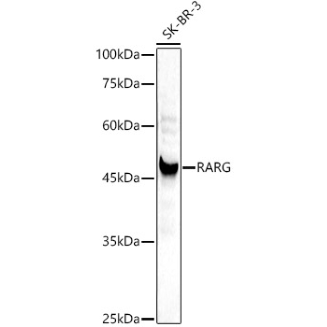 RARG Rabbit Polyclonal Antibody [KD Validated]