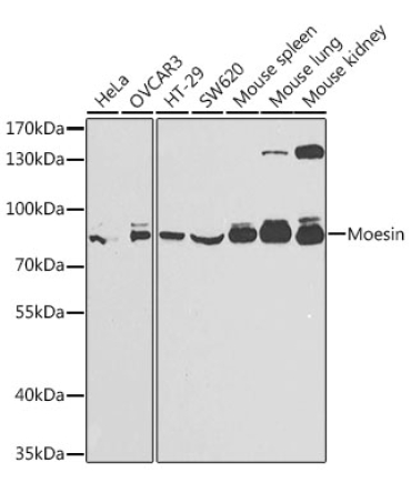 Moesin Rabbit Polyclonal Antibody