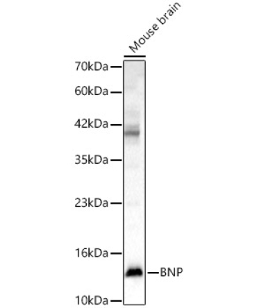 BNP Rabbit Polyclonal Antibody