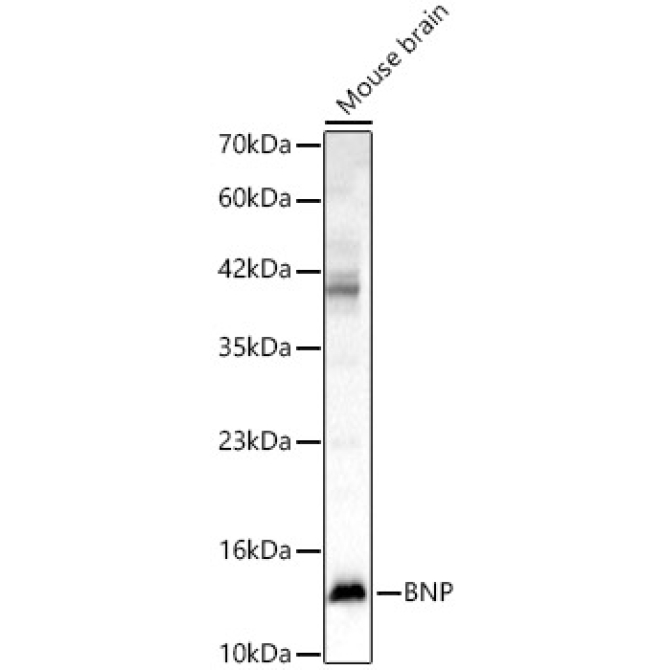 BNP Rabbit Polyclonal Antibody