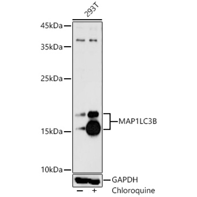 MAP1LC3B Rabbit Polyclonal Antibody