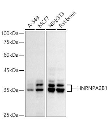 HNRNPA2B1 Rabbit Polyclonal Antibody
