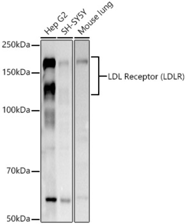 LDL Receptor (LDLR) Rabbit Polyclonal Antibody