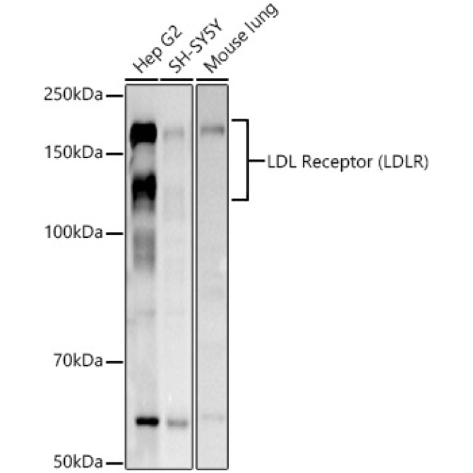 LDL Receptor (LDLR) Rabbit Polyclonal Antibody