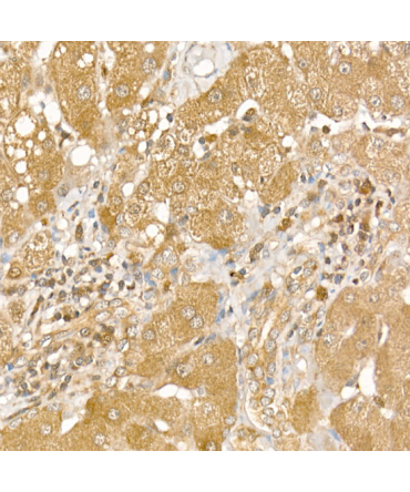 CSNK1E Rabbit Polyclonal Antibody