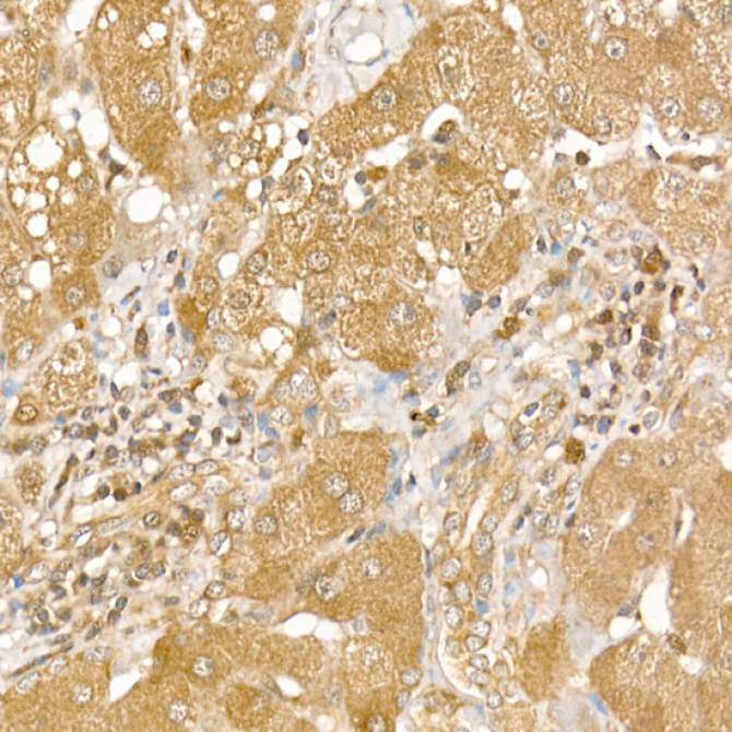 CSNK1E Rabbit Polyclonal Antibody